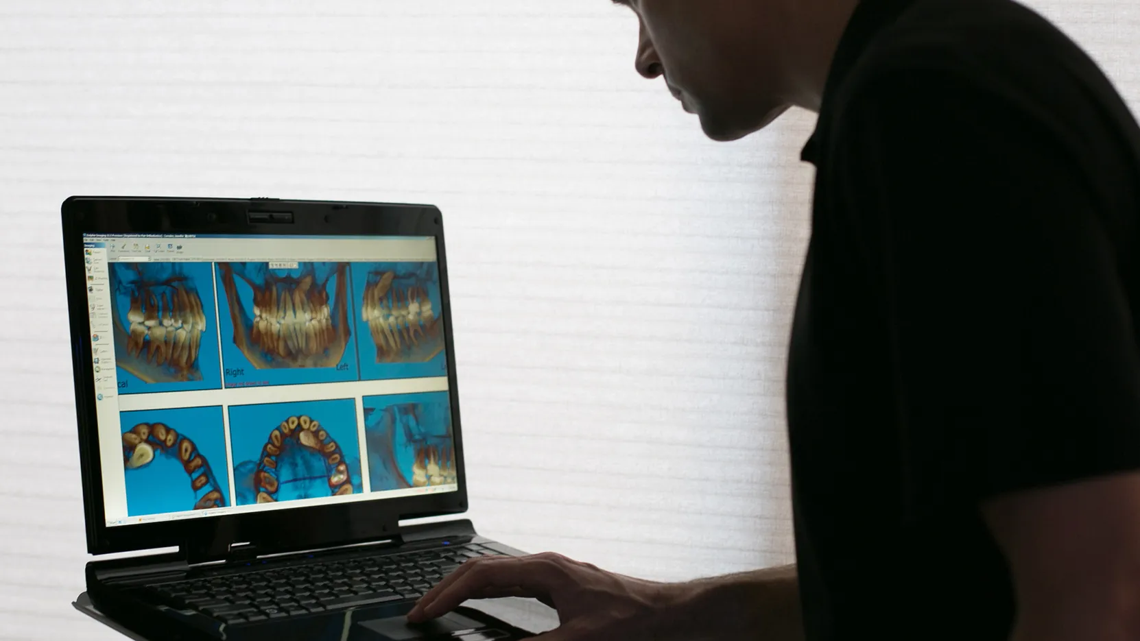 Orthodontist reviewing digital dental scans on a laptop