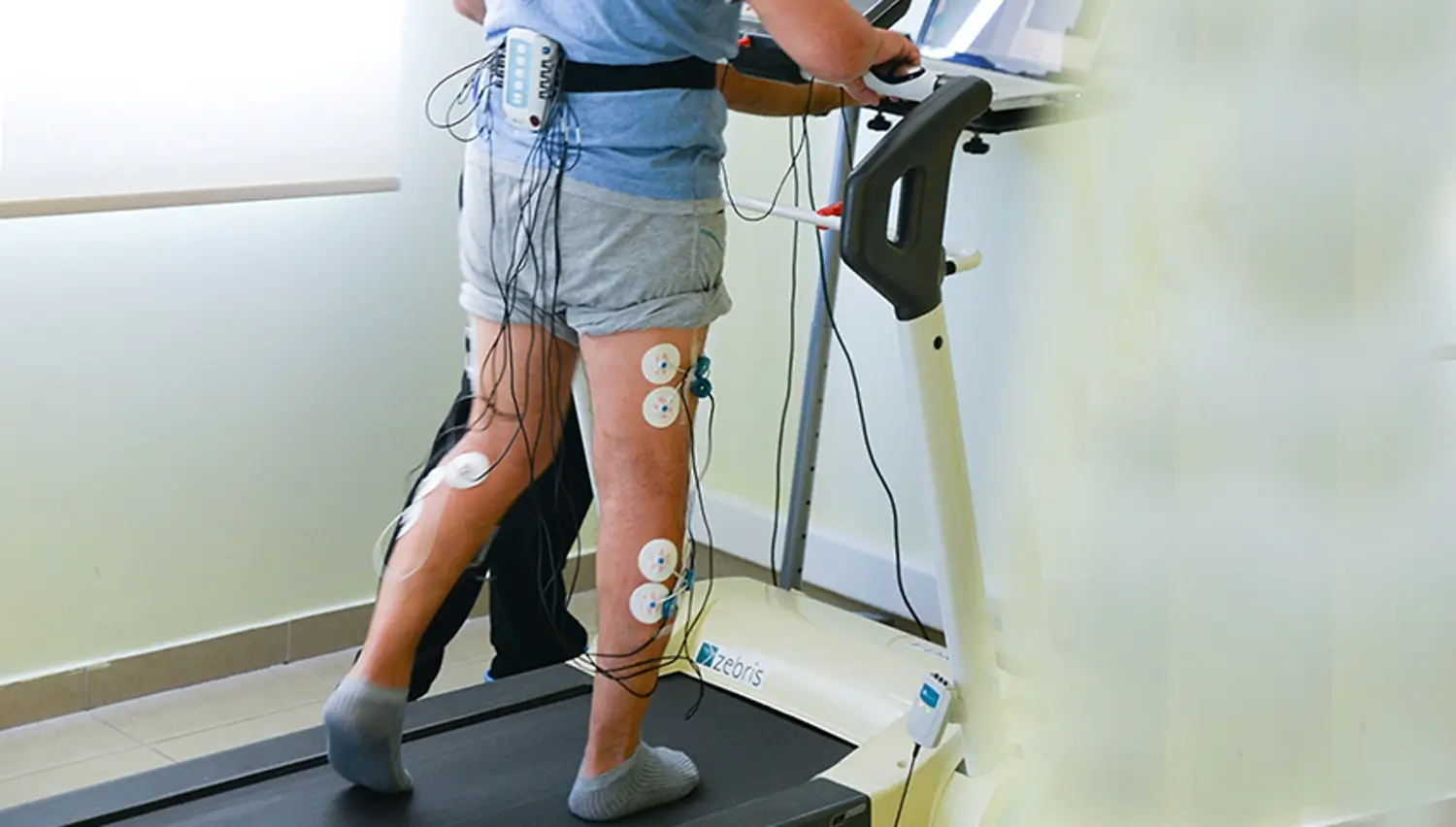Patient walking on a treadmill with adhesive electrodes and trailing wires attached to both legs