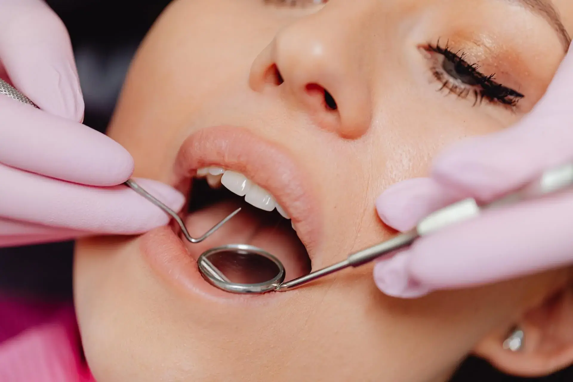 Dental check-up and exam at Willerby Dental Care