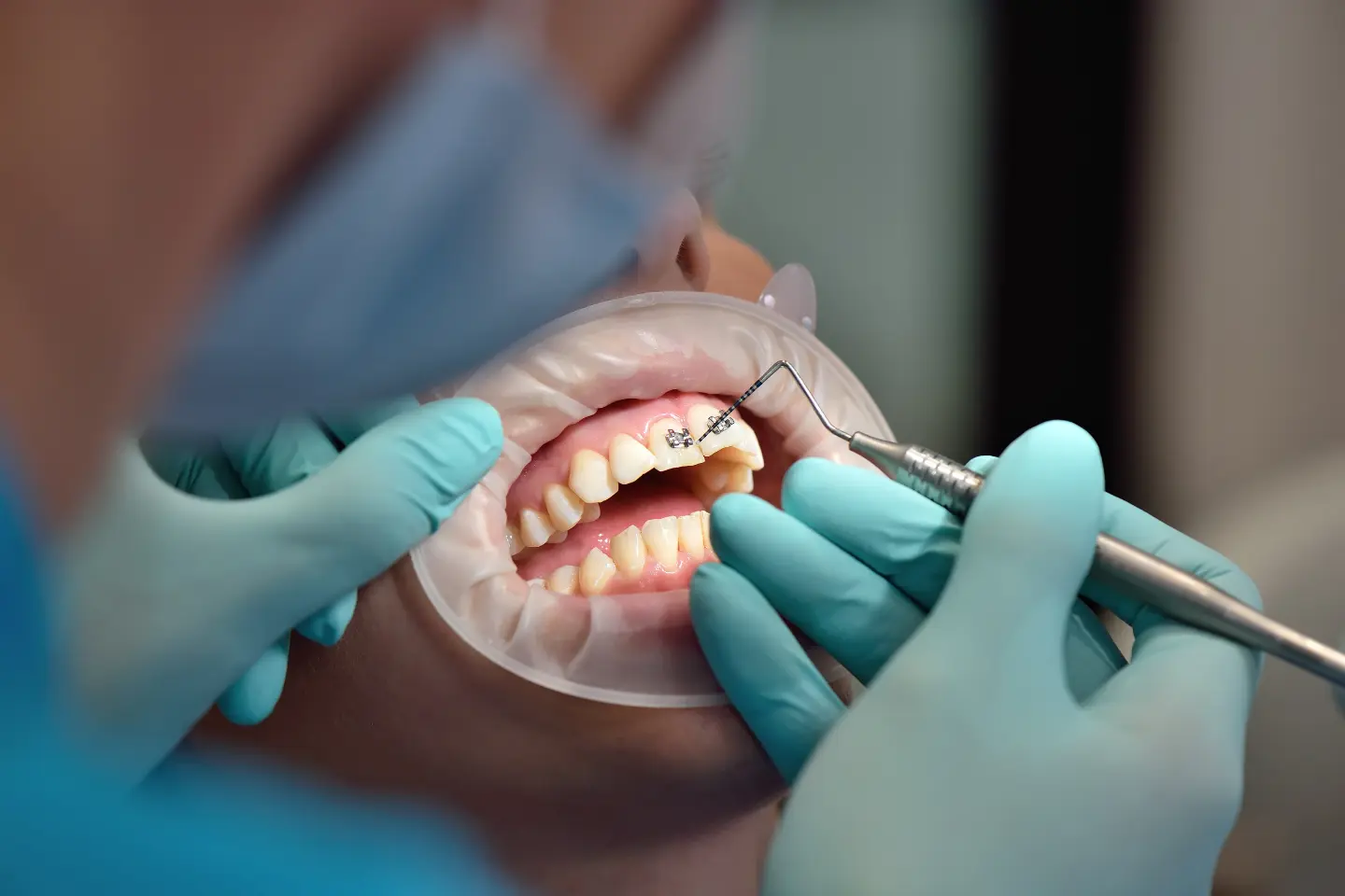 What is biomimetic dentistry — blog cover