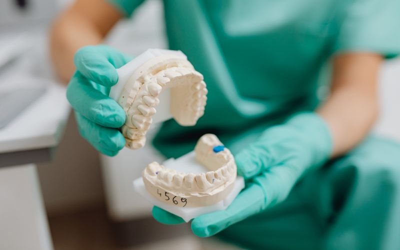 How to Replace Missing Teeth Without Dentures: Your Options Explained