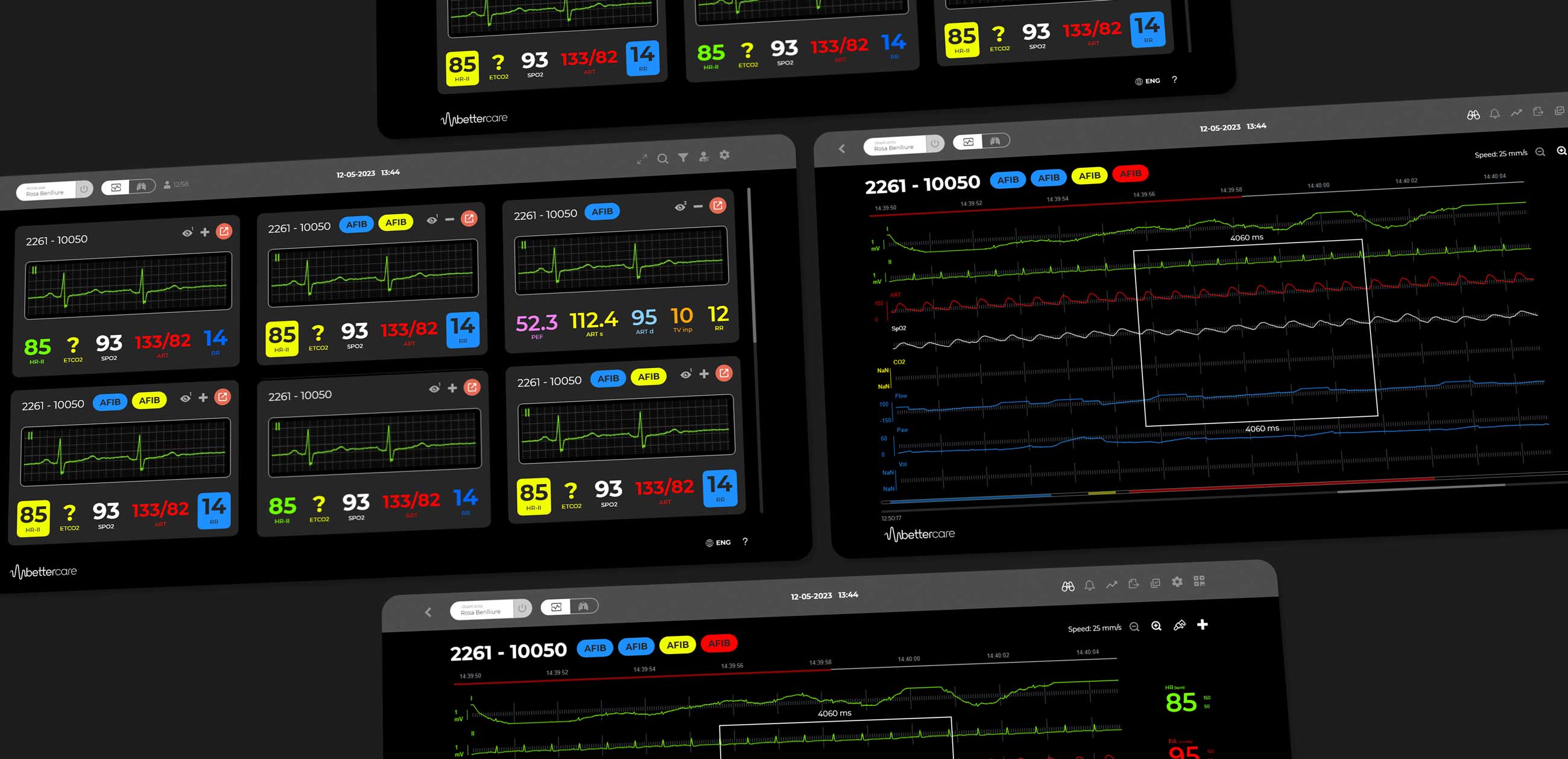 Pantallas de monitorización médica mostrando signos vitales y trazos de electrocardiograma con datos de presión arterial, frecuencia cardíaca y saturación de oxígeno.