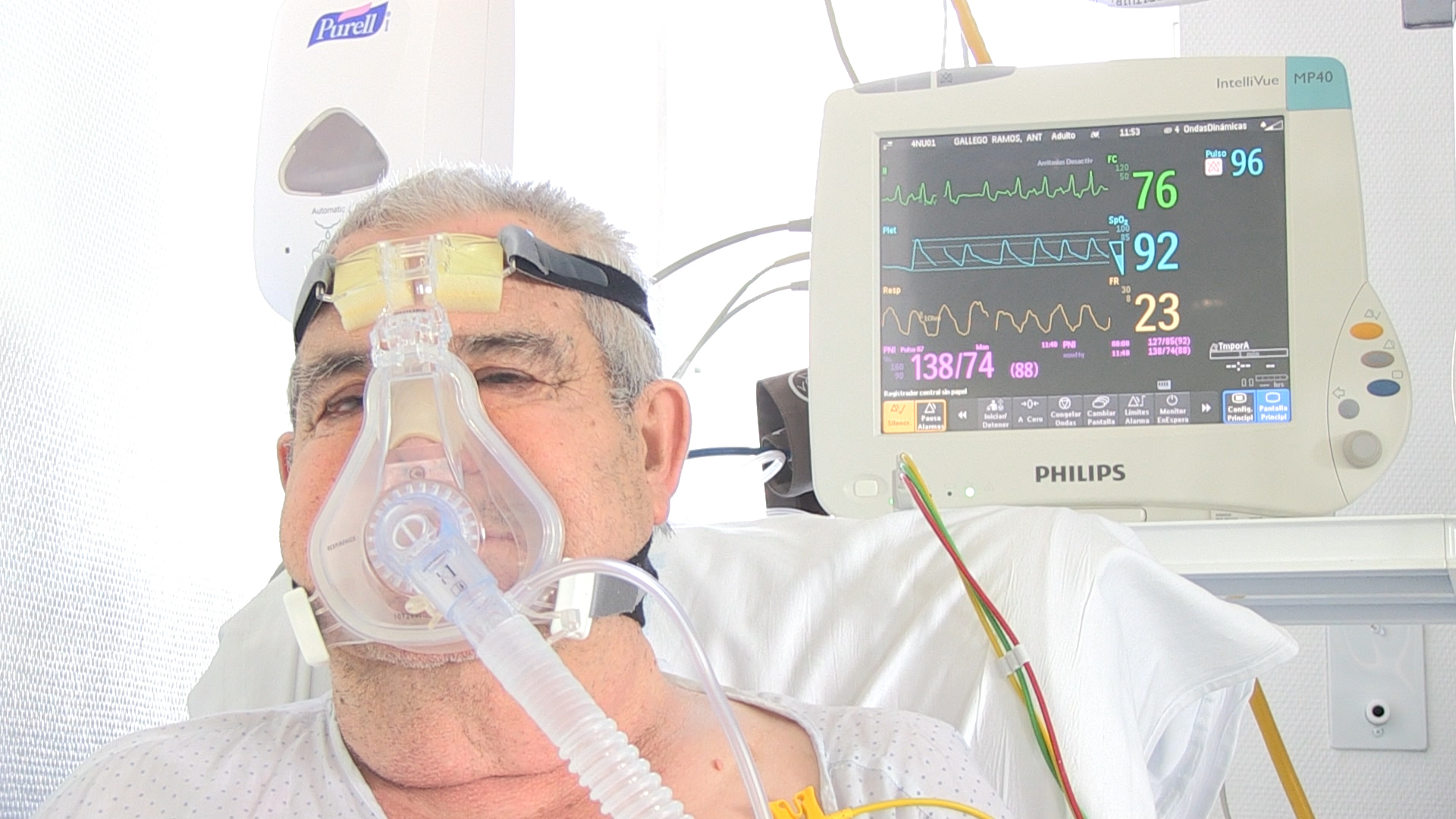 Artificial intelligence for detecting asynchronies in mechanical ventilation improves patient outcomes