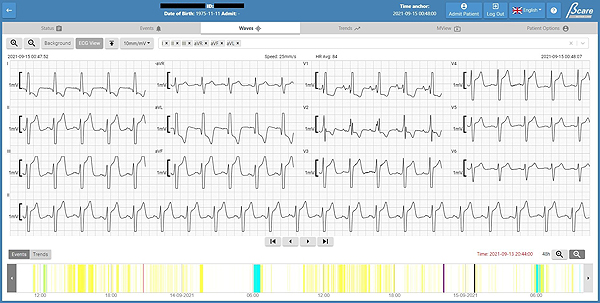 A tool has been validated to speed up decision-making in the care provided to critically ill patients