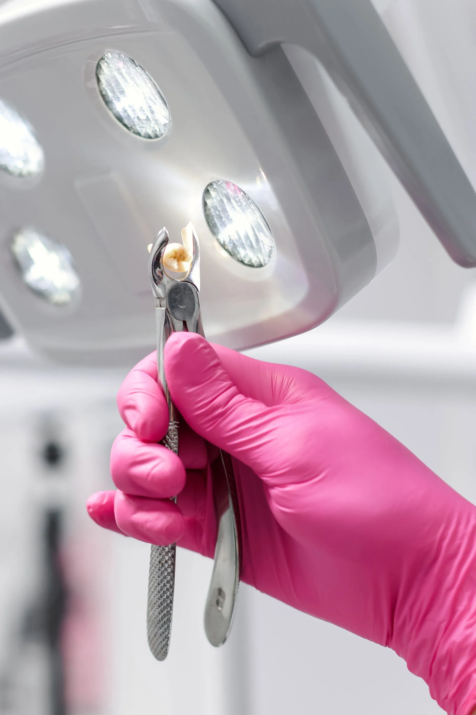 Gentle tooth extractions in Brookhaven, GA for damaged, infected, or painful teeth. Safe, comfortable care with patient-focused treatment.