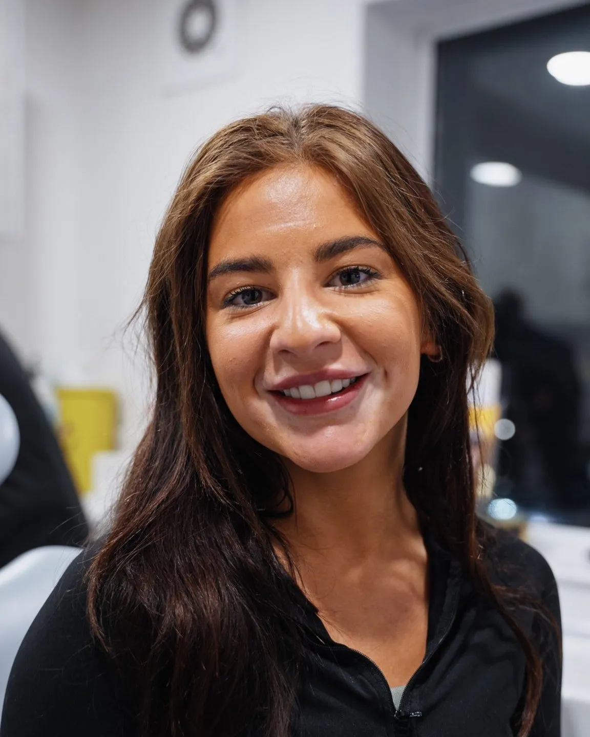 A real Sale Dental Spa patient smiling after treatment