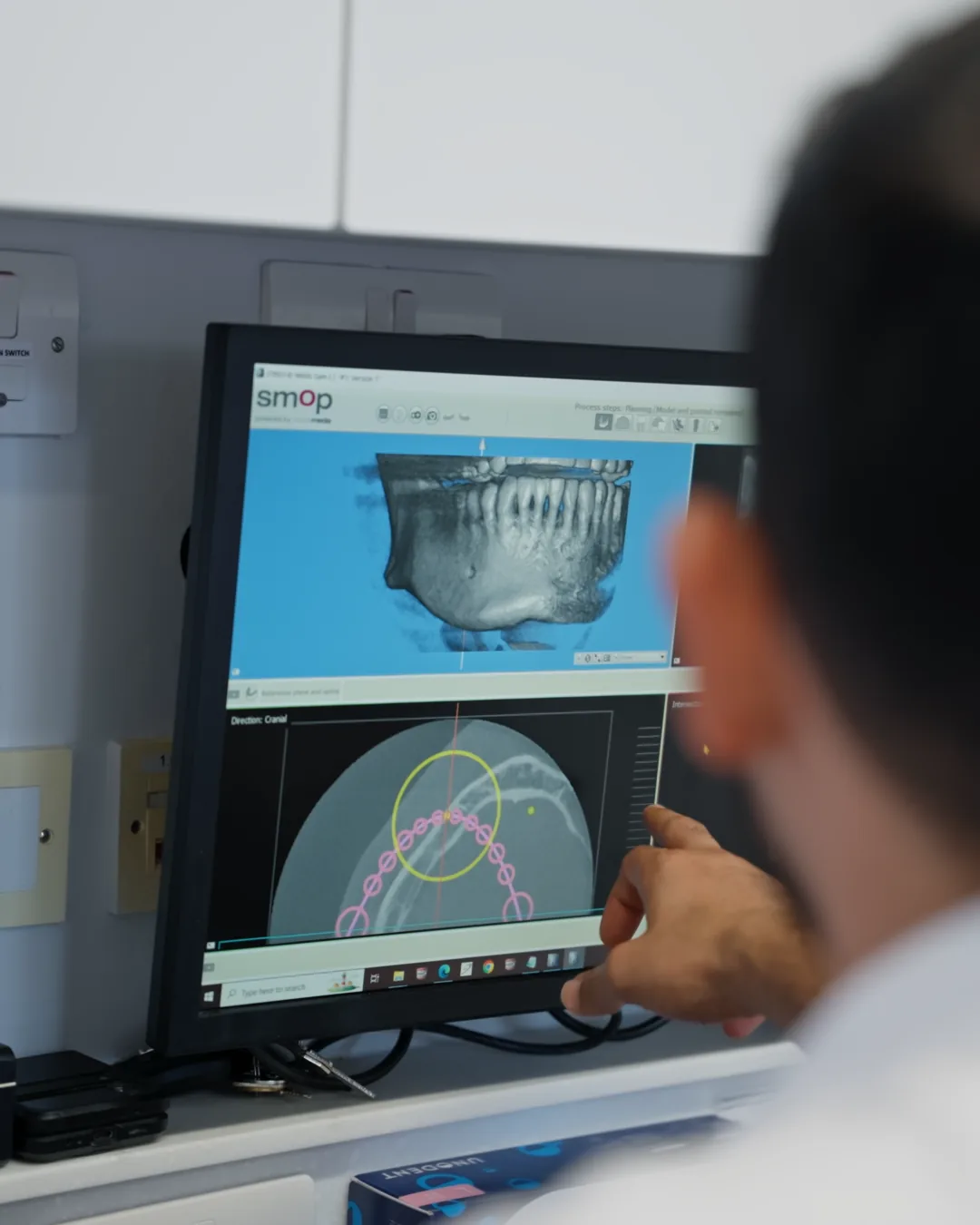 Dr JK reviewing a CBCT 3D scan on screen