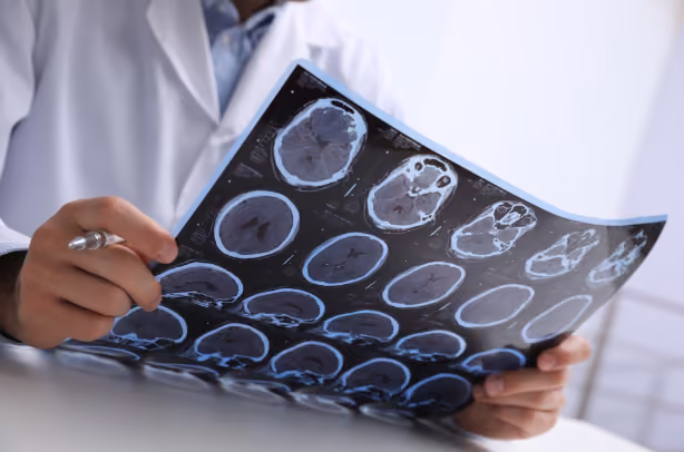 What is Epilepsy?