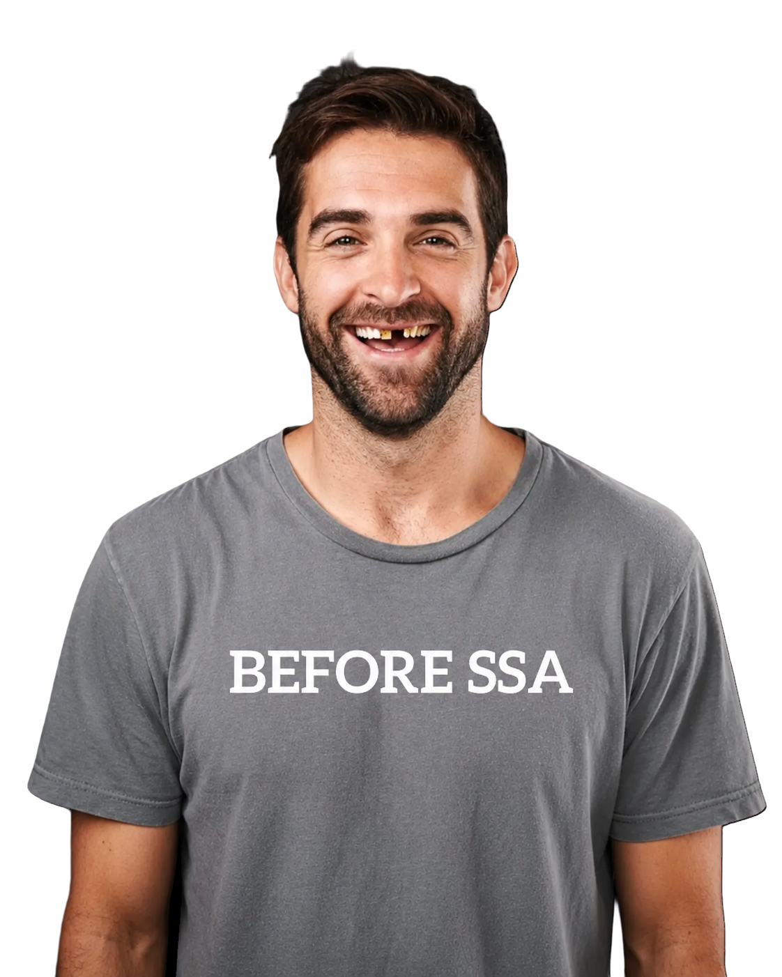 Before dental implants at Makris Dental — patient lacking confidence to smile