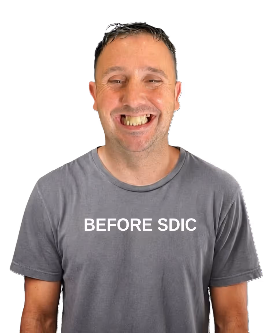 Before dental implants at Makris Dental — patient lacking confidence to smile