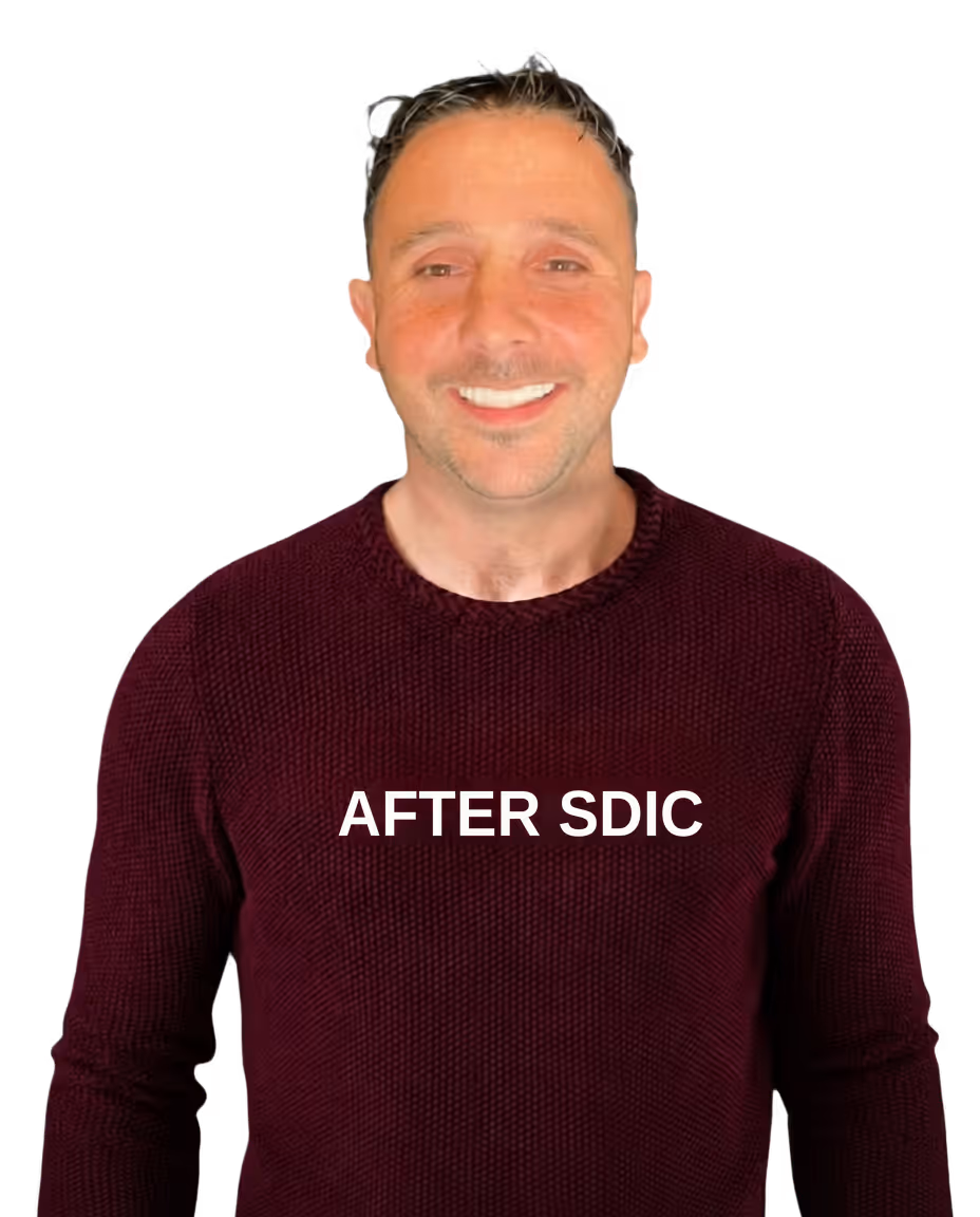 Before dental implants at Makris Dental — patient lacking confidence to smile