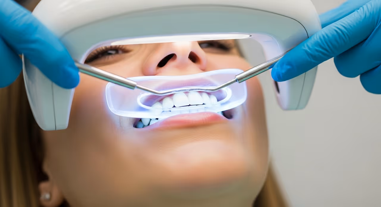 How Long Does Teeth Bonding Last for a Chipped Tooth?