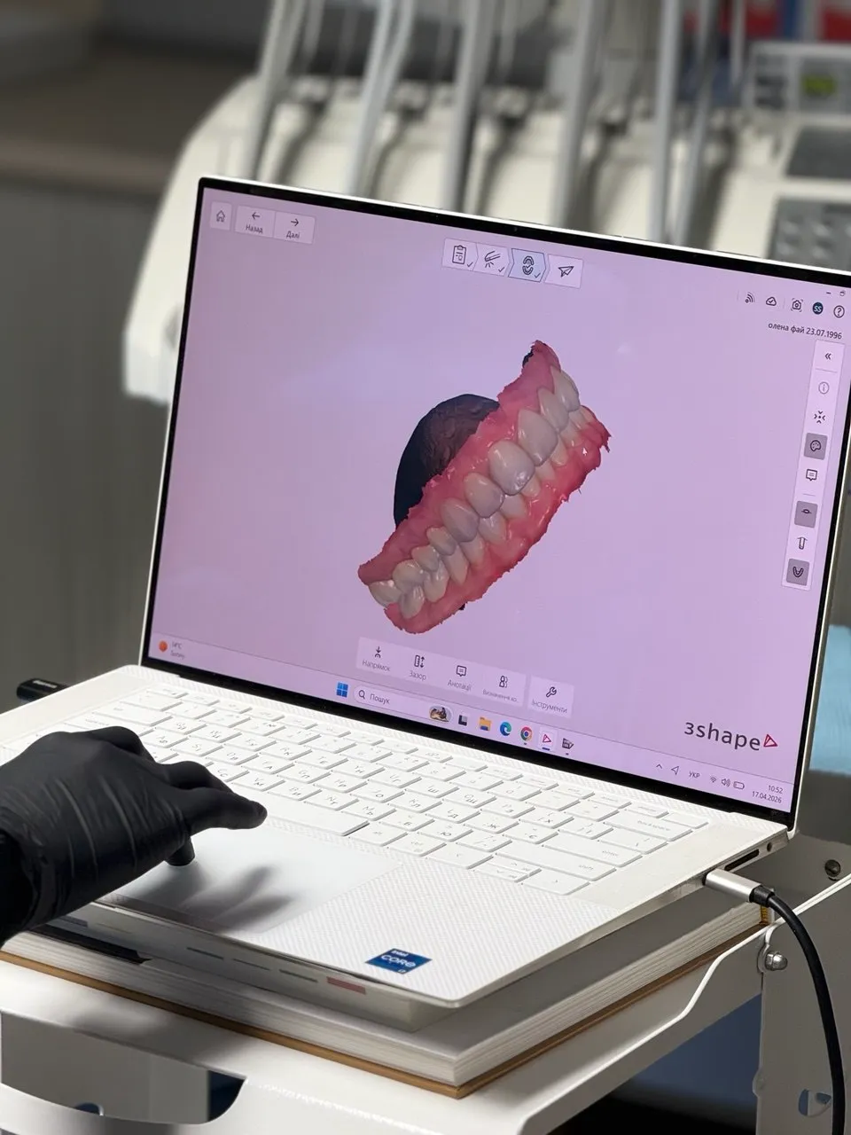 Laptop screen showing 3D dental model of teeth and gums with hand on keyboard.