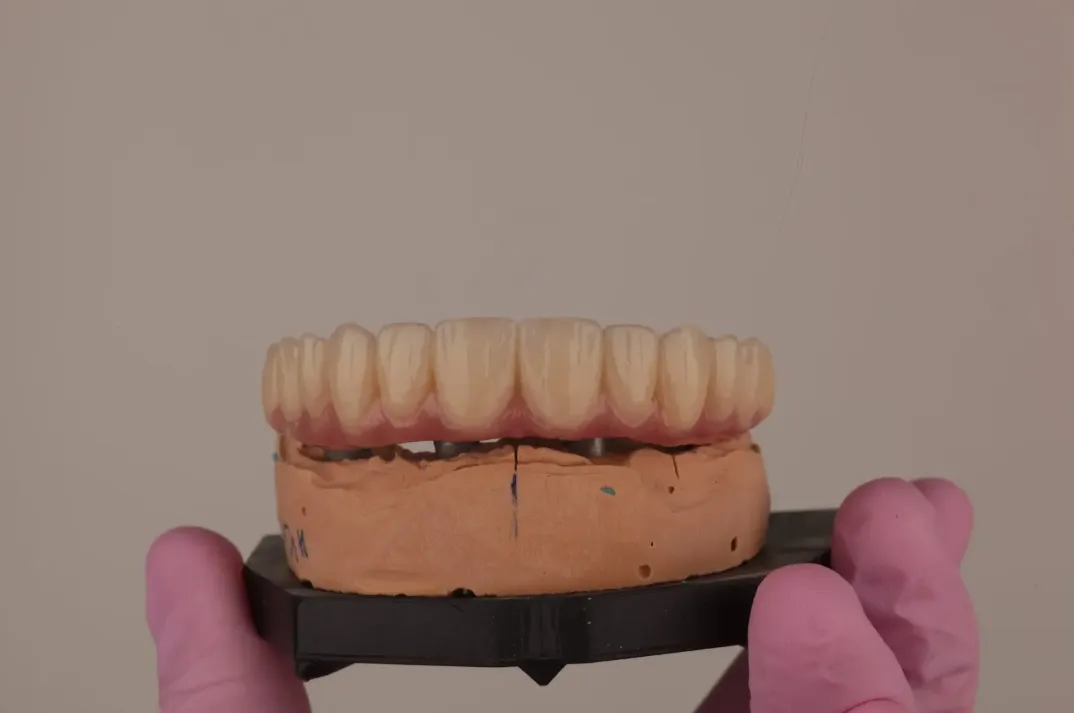 Dental technician holding a dental prosthetic model with artificial teeth and pink gloves.