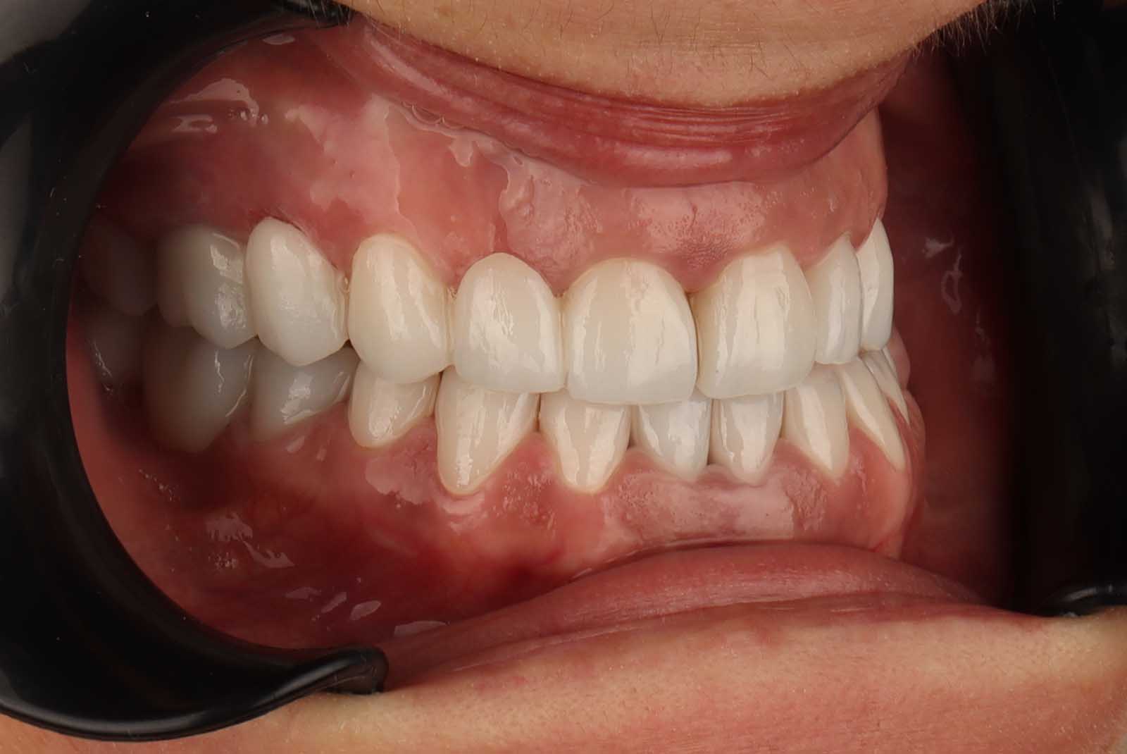 Osmijeh pacijenta nakon tretmana u TB Dent ordinaciji u Trebinju