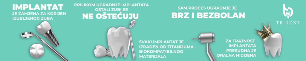 zubni implantati trebinje