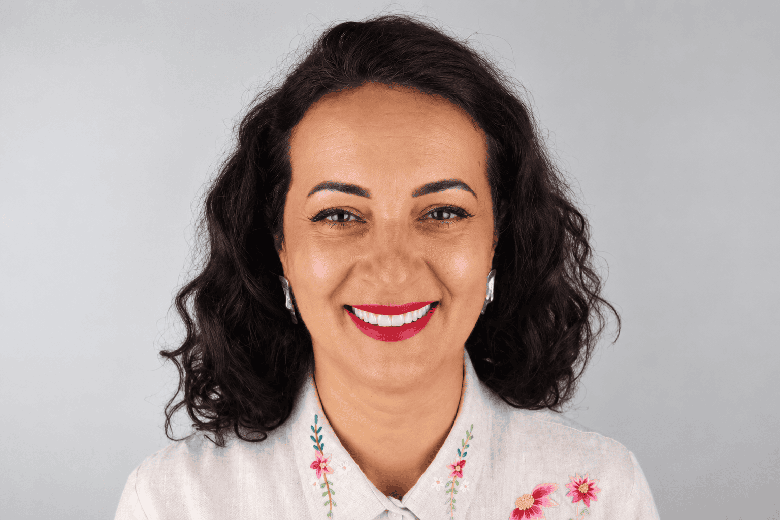 Hollywood Smile – estetska transformacija osmijeha u TB Dent Trebinje