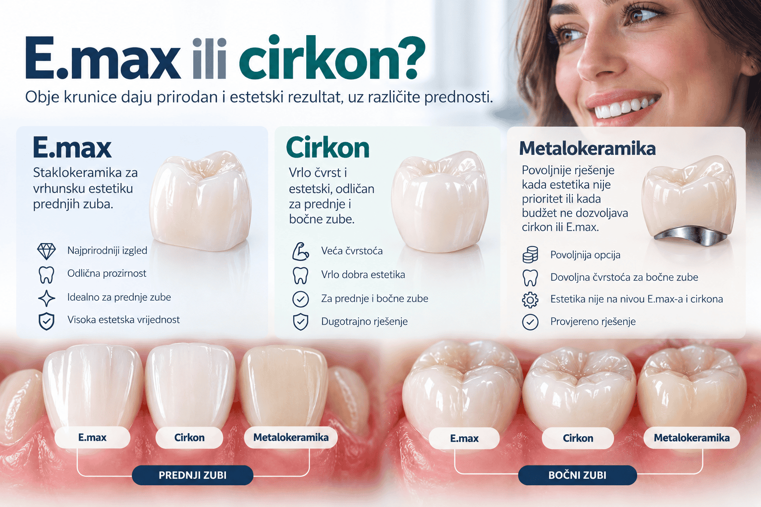 Poređenje E.max, cirkonskih i metalokeramičkih krunica – TB Dent Trebinje