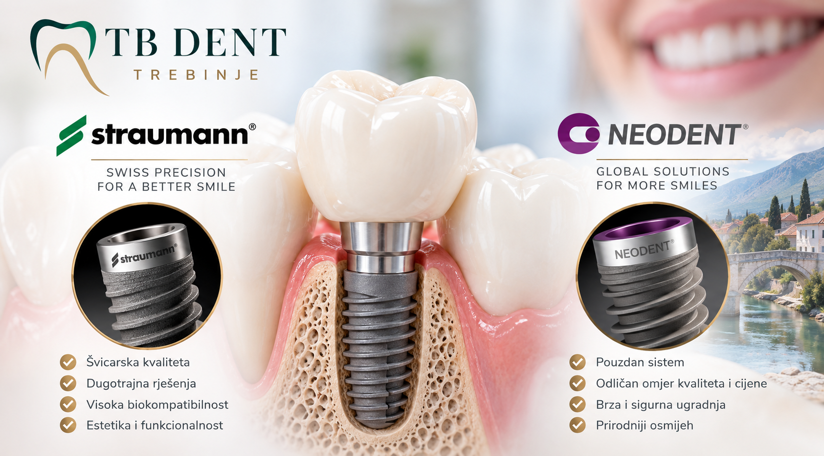 Zubni implantat sa krunicom, sistemi Straumann i Neodent, TB Dent Trebinje