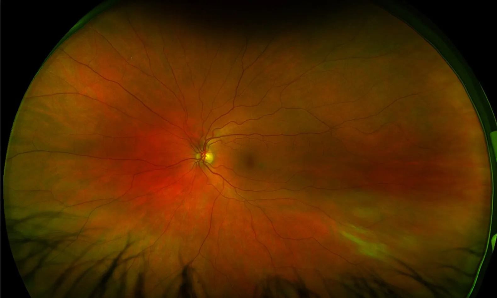 Optomap retinal eye scan at Neil Gordon Opticians