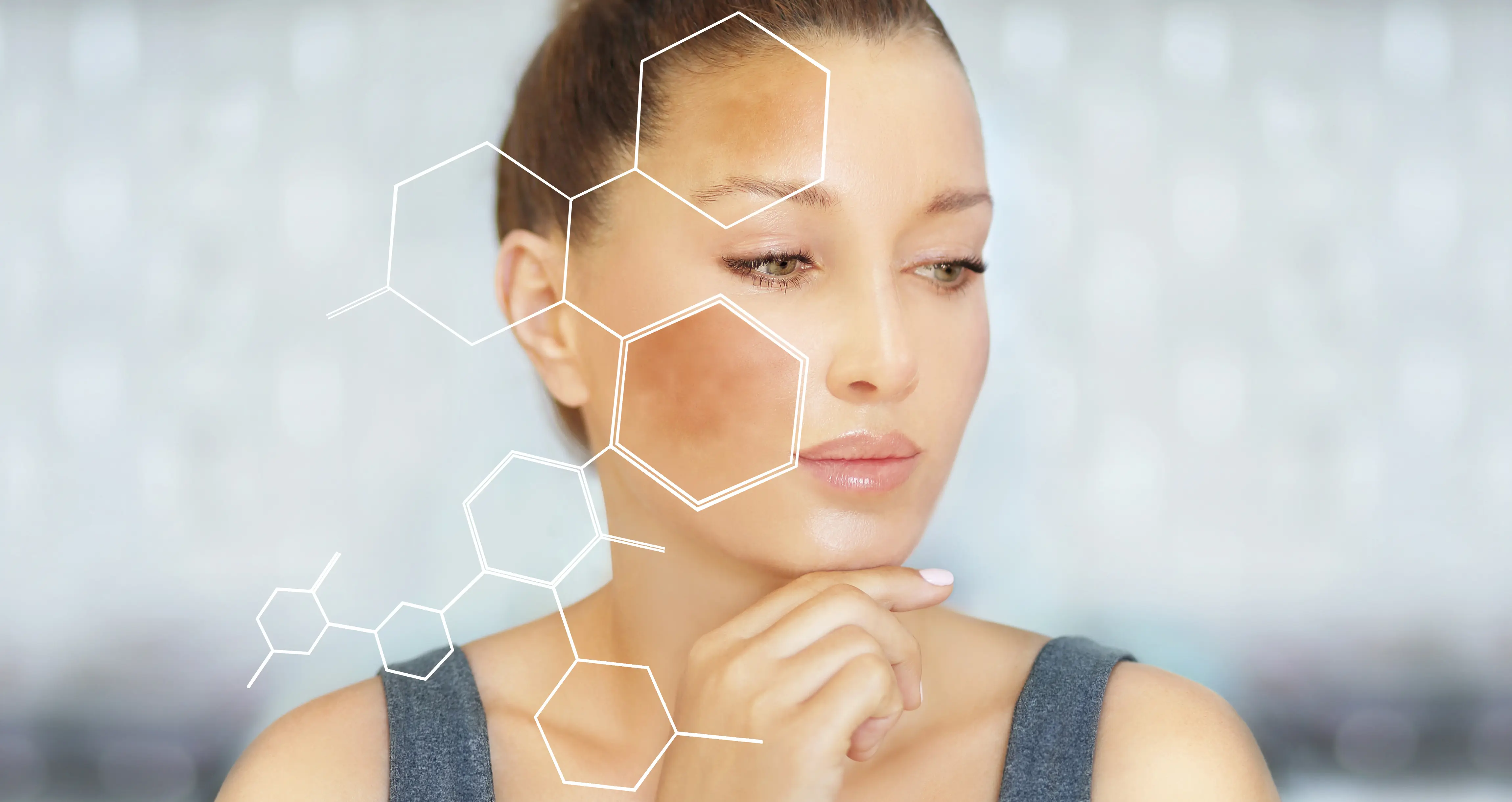 Skin Pigmentation 