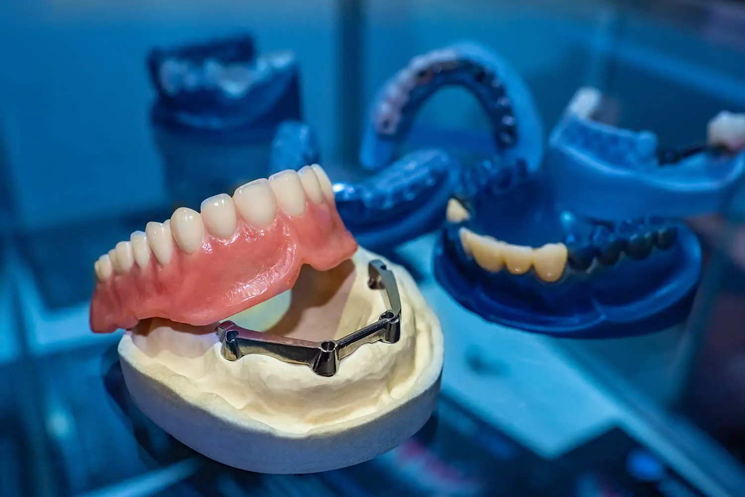Dental prosthetics on display including a partial denture and dental implant models.