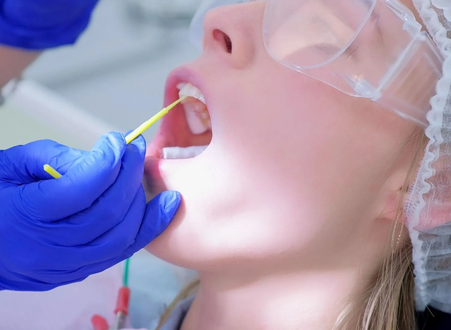 Dentist with blue gloves uses a dental tool inside an open mouth wearing protective glasses and hair net.