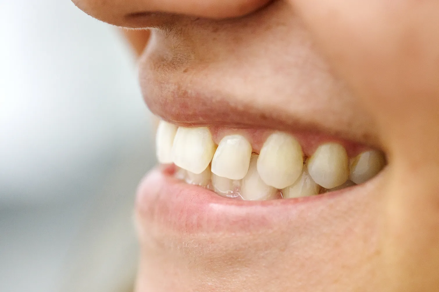 Close-up of a person's lower face showing a natural smile with visible upper and lower teeth and lips.