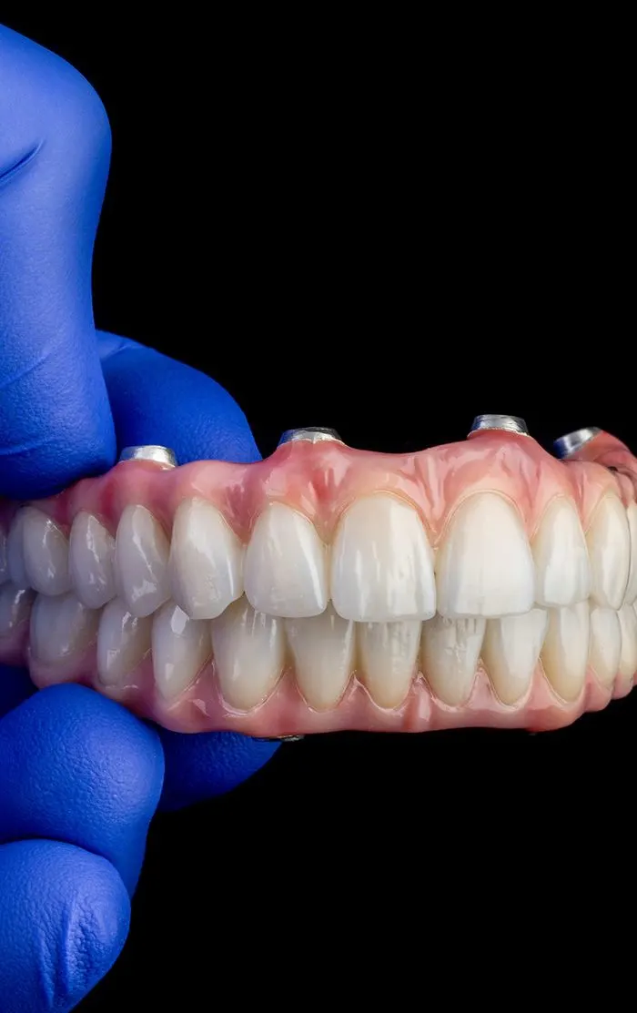 Take Your Smile To The Next Level With Implant Retained Dentures