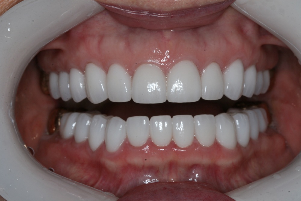 After Image