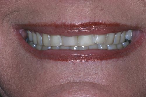 Before Image