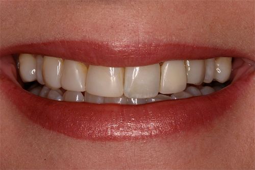 Before Image
