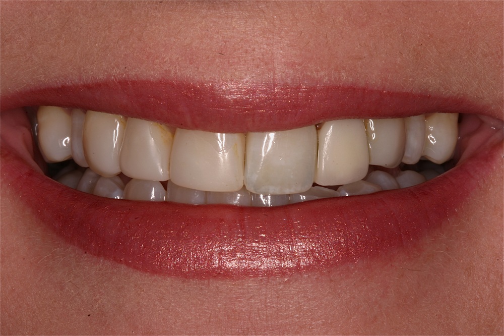 Before Image