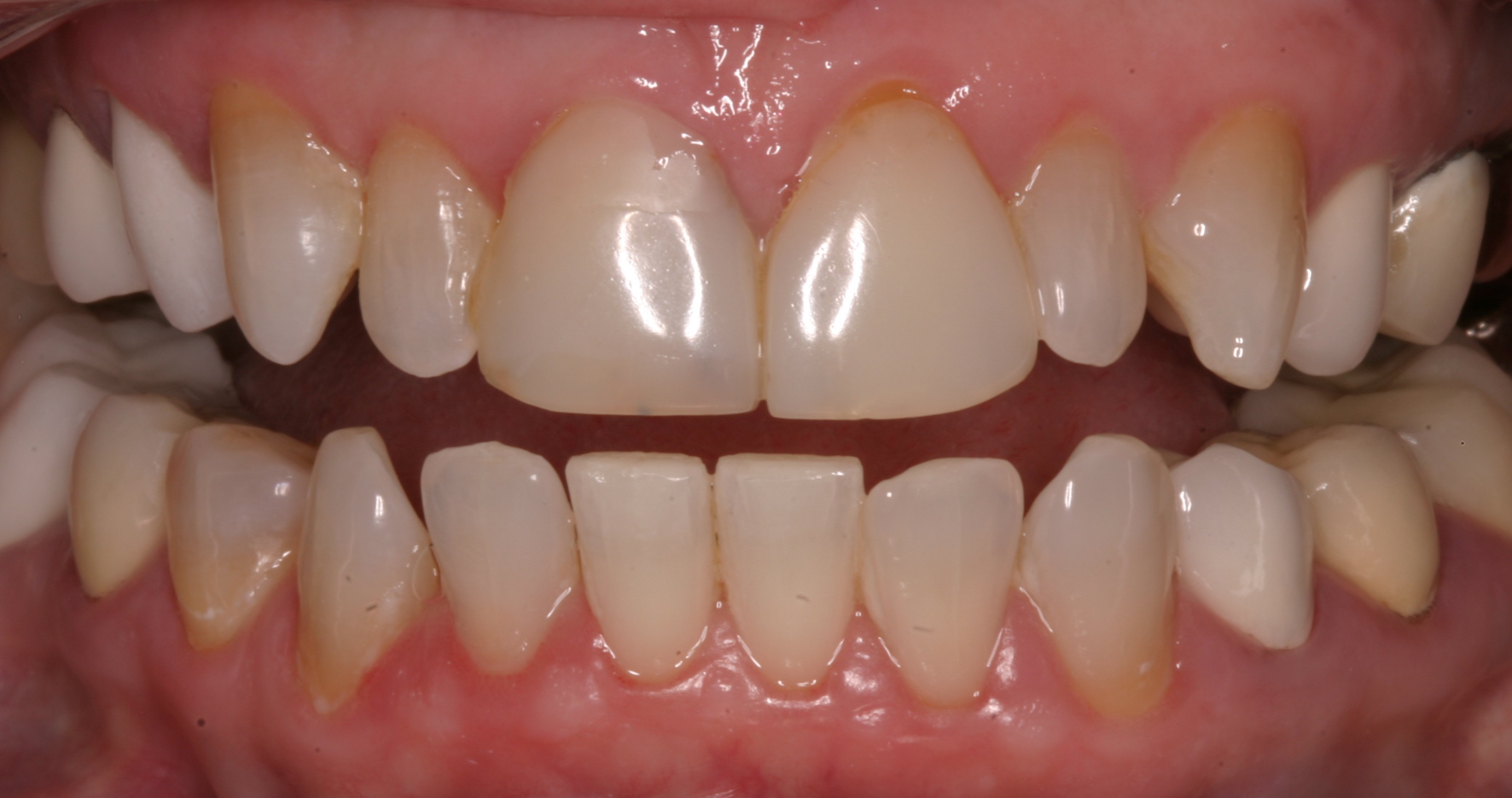 Before Image