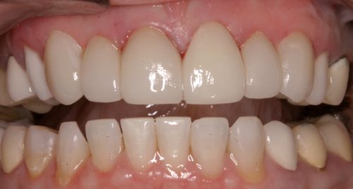 After Image
