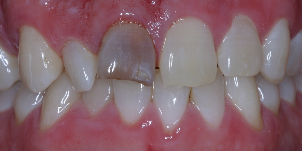 Before Image