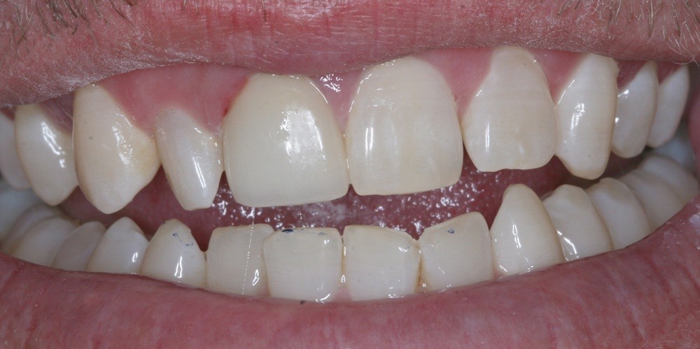 After Image