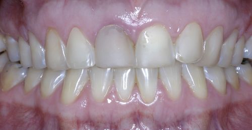 Before Image