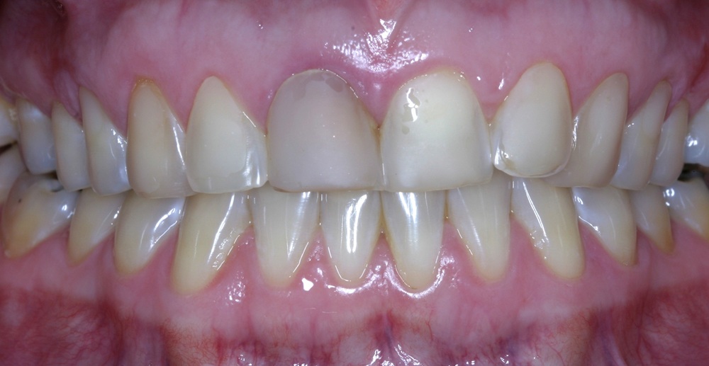 Before Image