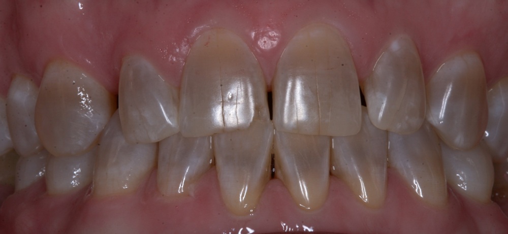 Before Image