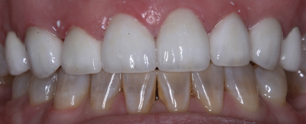 After Image
