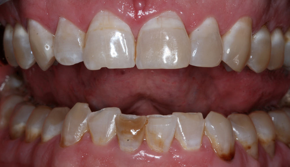 Before Image
