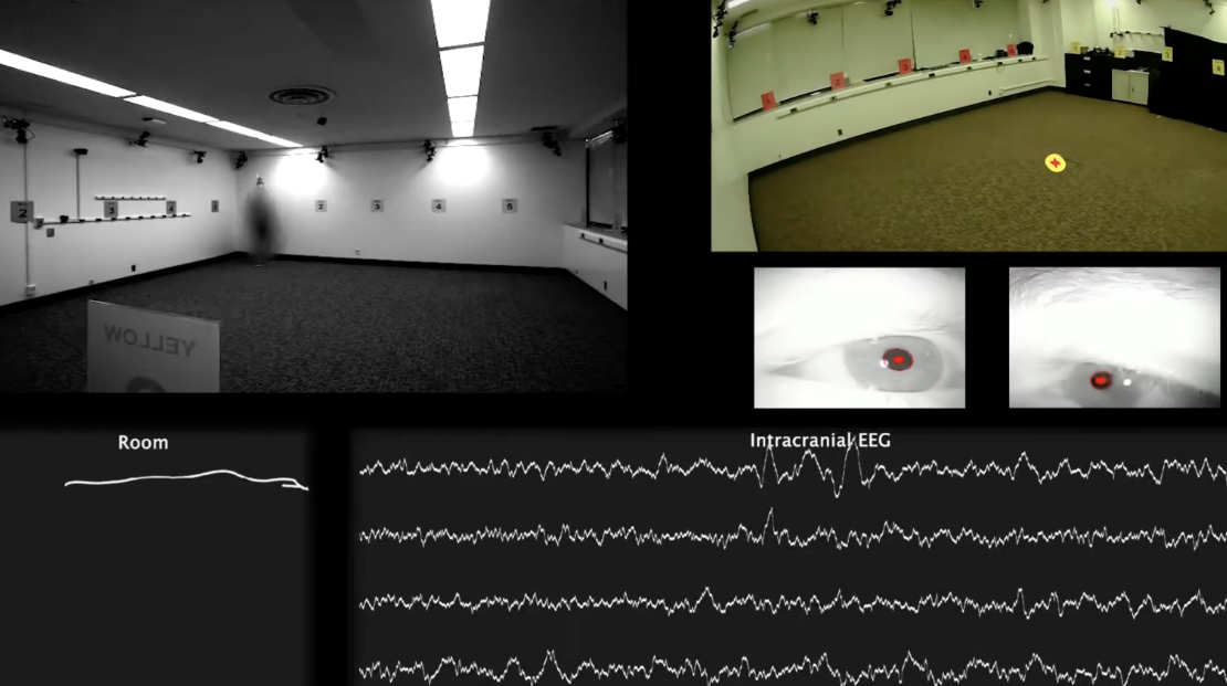 Mobile brain recording and stimulation platform