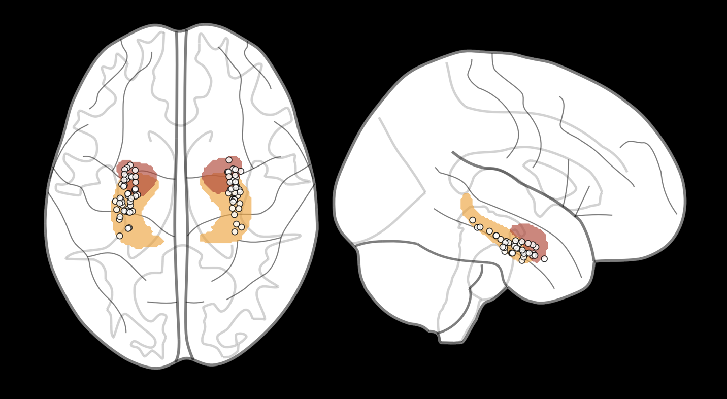 Line-style diagram depicting an electrode within a human brain from two views: birds-eye and from the side.