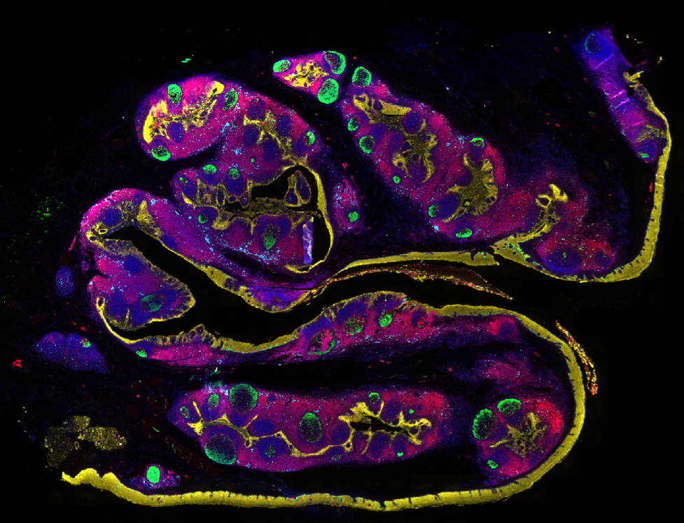 Multiplex immunofluorescence image of human tonsil stained with Revolune Illuminate-P4-R (DAPI-blue, Ki67-green, ATP1A1-yellow, CD68-purple, CD3-pink)