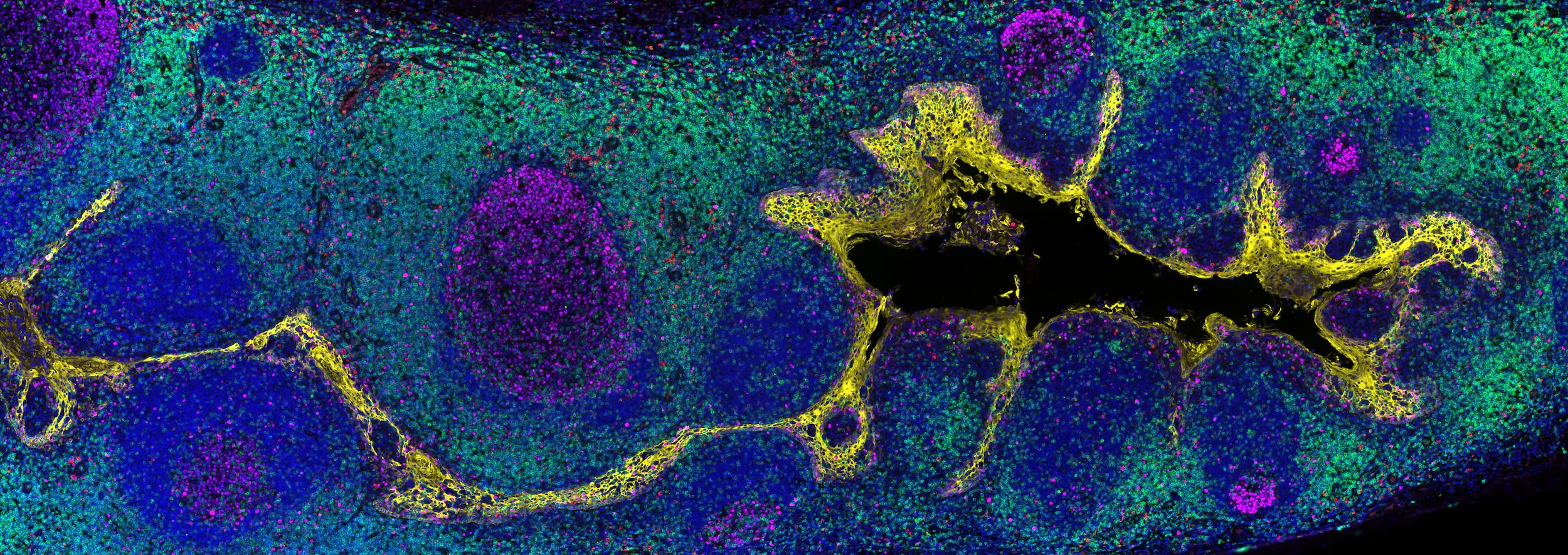 Multiplex immunofluorescence image of human tonsil stained with Revolune Illuminate-P4-R (DAPI-blue, Ki67-pink, ATP1A1_yellow, CD68-purple, CD3-green)