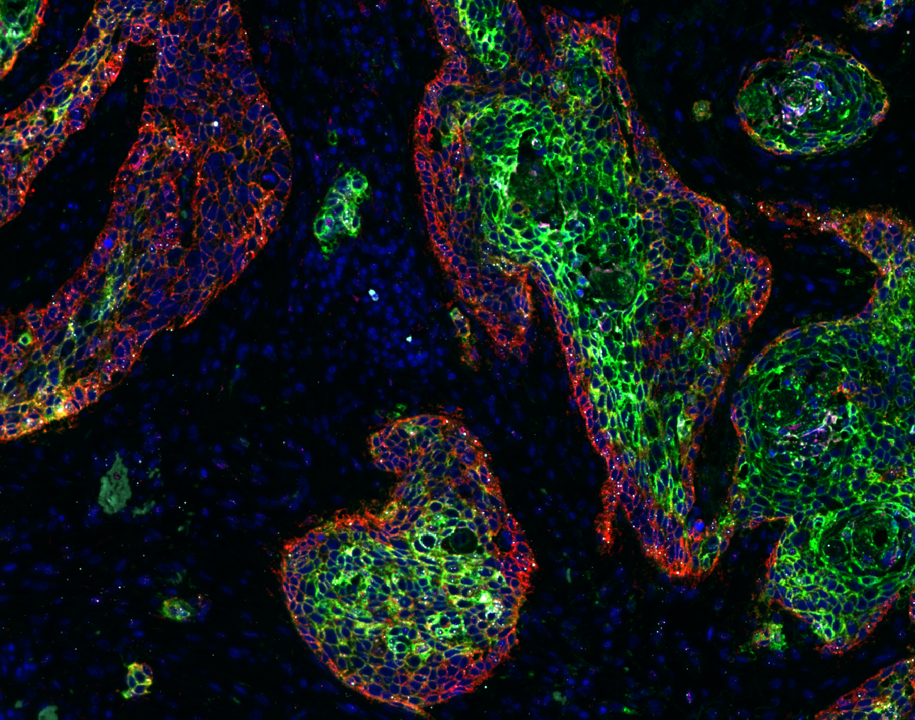 Multiplex immunofluorescence image of human bladder tissue stained with Revolune Illuminate-P4-R (DAPI-blue, EGFR-red, HER2-cyan, Nectin4-pink, TROP2-green)
