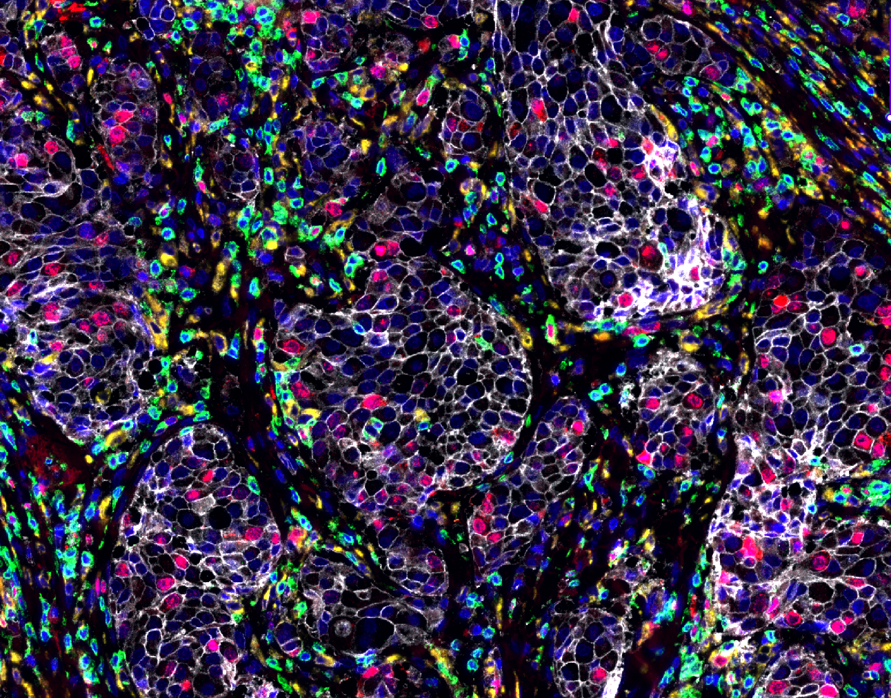 Multiplex immunofluorescence image of human healthy breast tissue stained with Revolune Illuminate-P4-R (DAPI-blue, Ki67-red, ATP1A1-white, CD68-yellow, CD3-green)