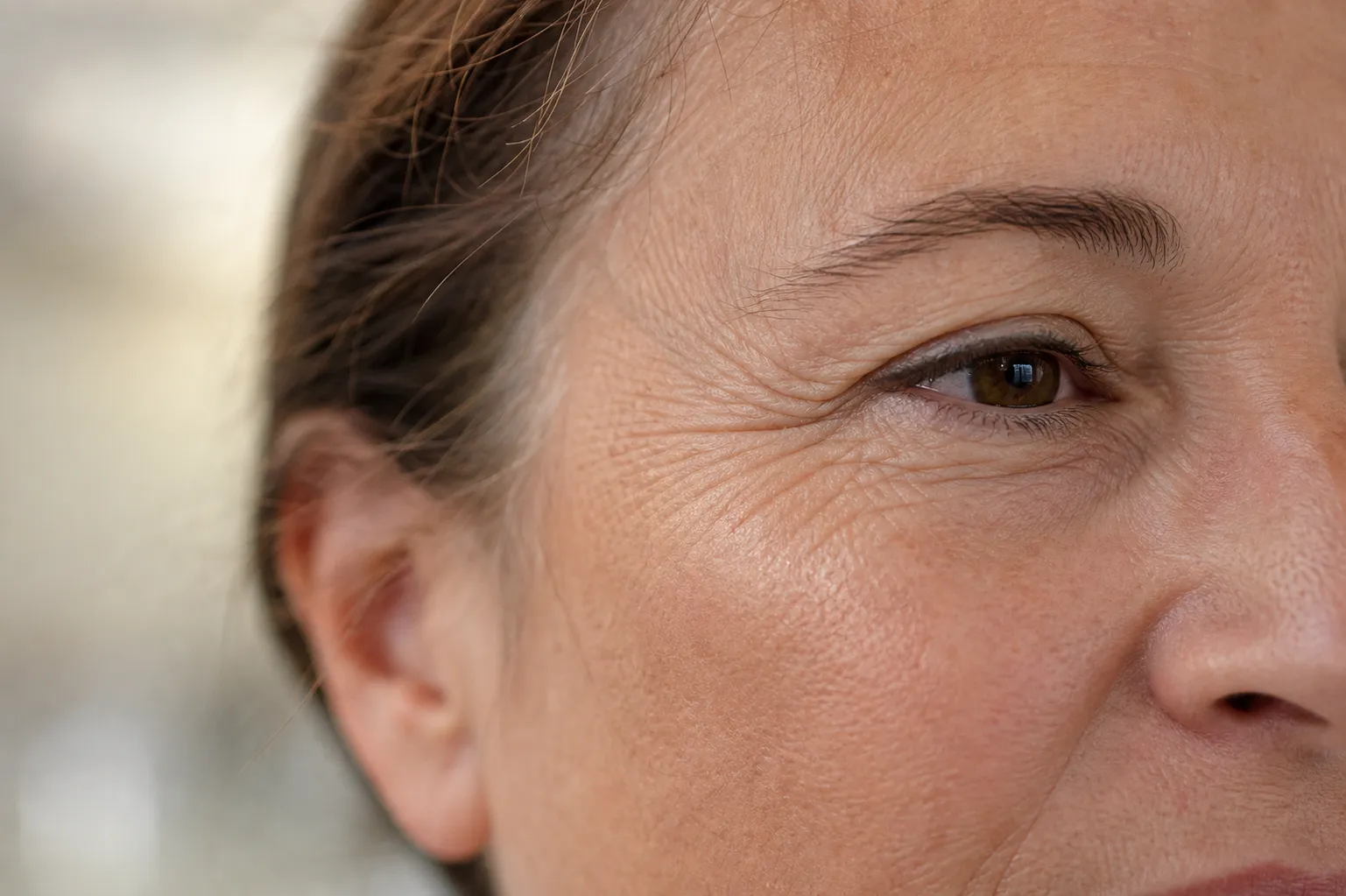 Close-up of a middle-aged woman's face showing skin wrinkles near her eye and temple.