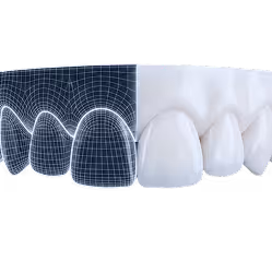 Zähne halb dargestellt mit 3D-Gittermodell links und realistischem Aussehen rechts.